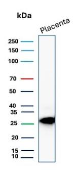 TFPI2 (Marker of Ovarian Carcinoma) Antibody in Western Blot (WB)
