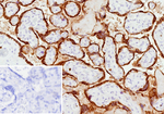 TFPI2 (Tissue Factor Pathway Inhibitor 2) (Marker of Ovarian Carcinoma) Monoclonal Antibody (TFPI2/13028)