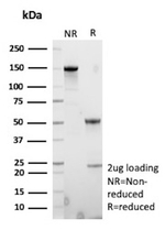 TFPI2 (Tissue Factor Pathway Inhibitor 2) (Marker of Ovarian Carcinoma) Antibody in SDS-PAGE (SDS-PAGE)