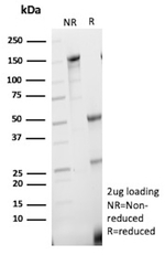 Homeobox protein NANOG (Cancer Stem Cell Marker) Antibody in SDS-PAGE (SDS-PAGE)