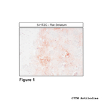 5-HT2C, 5-HT Receptor 2C Antibody in Immunohistochemistry (Paraffin) (IHC (P))