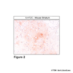 5-HT2C, 5-HT Receptor 2C Antibody in Immunohistochemistry (Paraffin) (IHC (P))