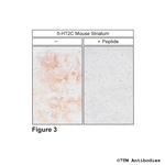 5-HT2C, 5-HT Receptor 2C Polyclonal Antibody
