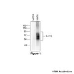 5-HT6 (5-HT Receptor 6) Polyclonal Antibody