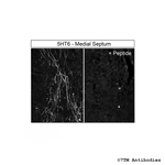 5-HT6, 5-HT Receptor 6 Polyclonal Antibody