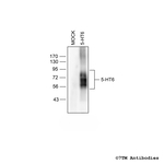5-HT6, 5-HT Receptor 6 Antibody in Western Blot (WB)