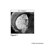 M1, M1 Muscarinic Acetylcholine Receptor Antibody in Immunohistochemistry (Paraffin) (IHC (P))