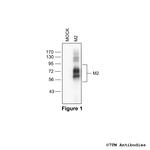 M2 (M2 Muscarinic Acetylcholine Receptor) Polyclonal Antibody