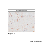 A2A, Adenosine 2A Receptor Polyclonal Antibody