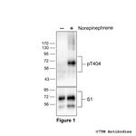 Phospho-beta-1-Adrenoceptor (Thr404) Polyclonal Antibody