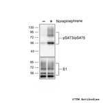 Phospho-beta-1-Adrenoceptor (Ser473, Ser475) Polyclonal Antibody