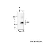 beta-1, beta-1-Adrenoceptor Polyclonal Antibody