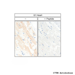 beta-1, beta-1-Adrenoceptor Antibody in Immunohistochemistry (Paraffin) (IHC (P))