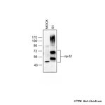 beta-1, beta-1-Adrenoceptor Antibody in Western Blot (WB)