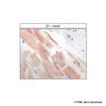 beta-1, beta-1-Adrenoceptor Antibody in Immunohistochemistry (Paraffin) (IHC (P))