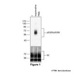 Phospho-beta-2-Adrenoceptor (Ser355, Ser356) Polyclonal Antibody