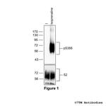 Phospho-beta-2-Adrenoceptor (Ser356) Polyclonal Antibody