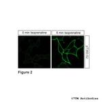 Phospho-beta-2-Adrenoceptor (Thr360) Antibody in Immunocytochemistry (ICC/IF)
