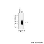 beta-2, beta-2-Adrenoceptor Polyclonal Antibody