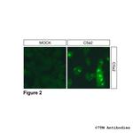 C5a2, Complement C5a Receptor 2 Antibody in Immunocytochemistry (ICC/IF)