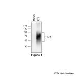 AT1 (Angiotensin Receptor 1) Polyclonal Antibody