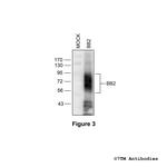 BB2, Bombesin Receptor 2/Gastrin-Releasing Peptide Receptor Antibody in Western Blot (WB)
