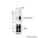 Phospho-Bombesin Receptor 3 (Thr363, Thr364) Polyclonal Antibody