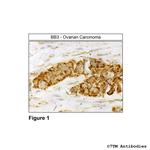 BB3, Bombesin Receptor 3 Polyclonal Antibody