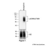 Phospho-Bradykinin Receptor 2 (Ser366, Thr369) Antibody in Western Blot (WB)