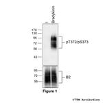 Phospho-Bradykinin Receptor 2 (Thr372, Ser373) Polyclonal Antibody