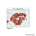 B2 (Bradykinin Receptor 2) Antibody in Immunohistochemistry (Paraffin) (IHC (P))