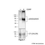 Phospho-Calcitonin Receptor (Ser422, Ser425) Polyclonal Antibody