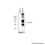 CALCR, Calcitonin Receptor-Like Receptor Antibody in Western Blot (WB)