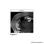 CALCR Calcitonin Receptor-Like Receptor Polyclonal Antibody