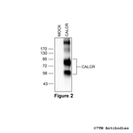 CALCR Calcitonin Receptor-Like Receptor Antibody in Western Blot (WB)