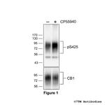 Phospho-Cannabinoid Receptor 1 (Ser425) Polyclonal Antibody