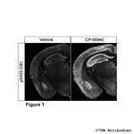 Phospho-Cannabinoid Receptor 1 (Ser425) Polyclonal Antibody