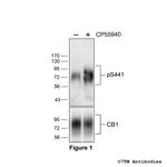 Phospho-Cannabinoid Receptor 1 (Ser441) Polyclonal Antibody