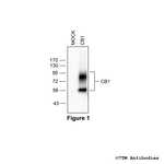 CB1, Cannabinoid Receptor 1 Antibody in Western Blot (WB)