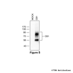 CB1, Cannabinoid Receptor 1 Antibody in Western Blot (WB)