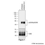 Phospho-Cannabinoid Receptor 2 (Ser335, Ser336) Polyclonal Antibody