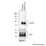Phospho-Cannabinoid Receptor 2 (Ser326) Polyclonal Antibody