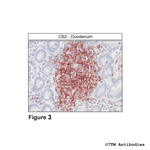 CB2, Cannabinoid Receptor 2 Polyclonal Antibody