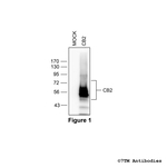 CB2, Cannabinoid Receptor 2 Antibody in Western Blot (WB)