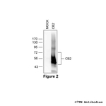CB2 Cannabinoid Receptor 2 Antibody in Western Blot (WB)