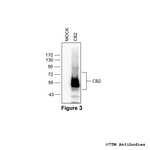 CB2 Cannabinoid Receptor 2 Antibody in Western Blot (WB)