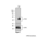Phospho-Chemokine Receptor 5 (Thr340) Antibody in Western Blot (WB)
