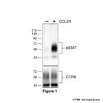 Phospho-Chemokine Receptor 6 (Ser357) Polyclonal Antibody
