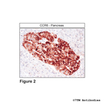 CCR6, Chemokine Receptor 6 Antibody in Immunohistochemistry (Paraffin) (IHC (P))