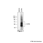 CCR6, Chemokine Receptor 6 Antibody in Western Blot (WB)